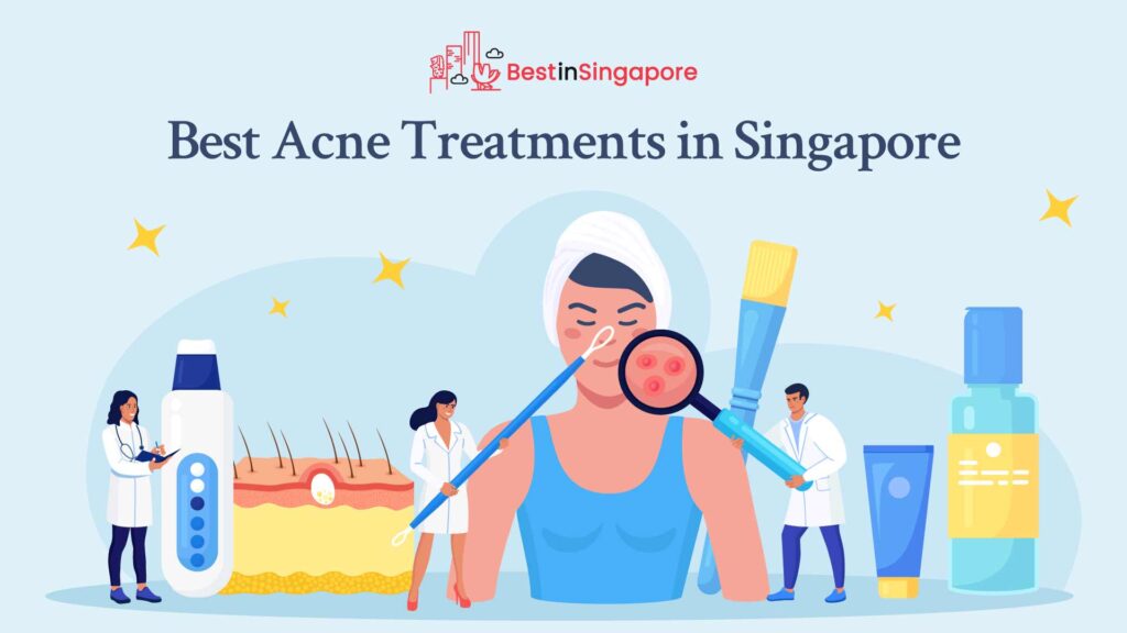 Best acne treatment Singapore