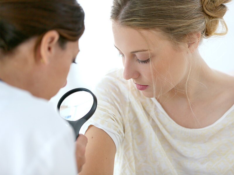 The Best Acne Treatment Singapore