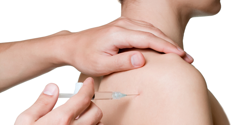 Trigger point Injections